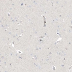 Immunohistochemical staining of human cerebral cortex shows weak cytoplasmic positivity in endothelial cells.