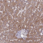 Immunohistochemical staining of human liver shows strong cytoplasmic positivity in hepatocytes.