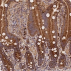 Immunohistochemical staining of human duodenum shows strong cytoplasmic positivity in glandular cells and moderate cytoplasmic positivity in lymphoid cells.