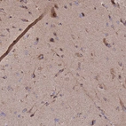 Immunohistochemical staining of human cerebral cortex shows moderate cytoplasmic positivity in subset of neuronal cells and weak cytoplasmic positivity in neuropil.