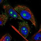Immunofluorescent staining of human cell line U-251 MG shows localization to nucleoli & cytosol.