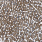 Immunohistochemical staining of human liver shows strong cytoplasmic positivity in hepatocytes.