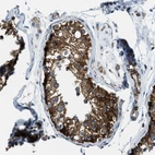 Immunohistochemical staining of human testis shows strong cytoplasmic positivity in cells in seminiferous ducts.
