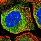 Immunofluorescent staining of human cell line A-431 shows localization to endoplasmic reticulum.
