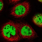 Immunofluorescent staining of human cell line A-431 shows localization to nucleoplasm.