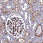 Immunohistochemical staining of human kidney shows moderate cytoplasmic/cytoplasmic membranous positivity in cells in glomeruli and cells in tubules.