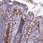Immunohistochemical staining of human colon shows strong cytoplasmic positivity in glandular cells and subset of goblet cells and lymphoid cells.