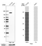 Western blot analysis in human cell lines U2OS and A-431 using Anti-TNS1 antibody. Corresponding TNS1 RNA-seq data are presented for the same cell lines. Loading control: Anti-PFN1.