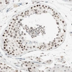 Immunohistochemical staining of human testis shows strong nuclear positivity in cells in seminiferous ducts.