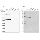 Western blot analysis using Anti-PUF60 antibody HPA059714 (A) shows similar pattern to independent antibody HPA052096 (B).