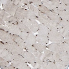 Immunohistochemical staining of human skeletal muscle shows strong nuclear positivity in myocytes.