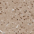 Immunohistochemical staining of human cerebral cortex shows strong nuclear positivity in neuronal cells and cytoplasmic positivity in neuropil.