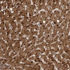 Immunohistochemical staining of human liver shows strong nuclear positivity in hepatocytes with additional cytoplasmic positivity.