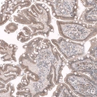 Immunohistochemical staining of human upper gastrointestinal tract shows moderate membranous positivity in glandular cells.