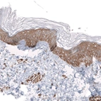 Immunohistochemical staining of human skin shows strong membranous and cytoplasmic positivity in squamous epithelial cells.