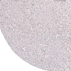 Immunohistochemical staining of human liver shows no membranous positivity in hepatocytes as expected.