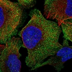 Immunofluorescent staining of human cell line U-2 OS shows localization to plasma membrane & centrosome.