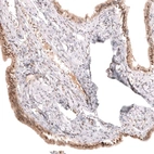 Immunohistochemical staining of human fallopian tube shows moderate nuclear and cytoplasmic positivity in glandular cells.