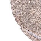 Immunohistochemical staining of human tonsil shows moderate nuclear positivity in non-germinal center cells.