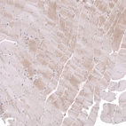 Immunohistochemical staining of human skeletal muscle shows no nuclear positivity in myocytes as expected.