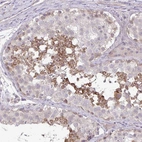 Immunohistochemical staining of human testis shows moderate cytoplasmic/cytoplasmic membranous positivity in subset of cells in seminiferous ducts.