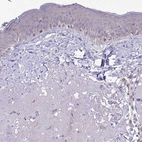 Immunohistochemical staining of human skin shows no positivity in squamous epithelial cells as expected.