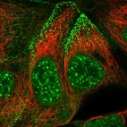 Immunofluorescent staining of human cell line CACO-2 shows localization to nuclear speckles & cell junctions.