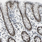 Immunohistochemical staining of human colon shows moderate nuclear positivity in glandular cells.