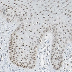Immunohistochemical staining of human skin shows moderate nuclear positivity in squamous epithelial cells.