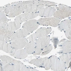 Immunohistochemical staining of human skeletal muscle shows very weak positivity in a subset of myocytes.