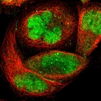 Immunofluorescent staining of human cell line A-431 shows localization to nucleus & nuclear bodies.