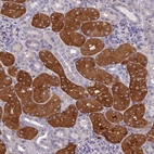 Immunohistochemical staining of human kidney shows strong cytoplasmic positivity in subset of cells in tubules.