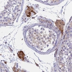 Immunohistochemical staining of human testis shows strong cytoplasmic positivity in subset of Leydig cells.