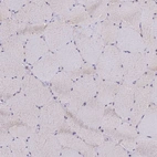 Immunohistochemical staining of human skeletal muscle shows no positivity in myocytes.