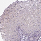 Immunohistochemical staining of human skin shows weak membranous positivity in squamous epithelial cells.