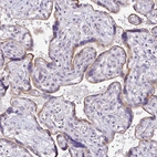 Immunohistochemical staining of human placenta shows moderate membranous positivity in trophoblastic cells.