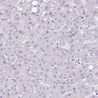 Immunohistochemical staining of human liver shows no positivity in hepatocytes.