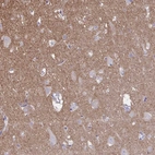 Immunohistochemical staining of human cerebral cortex shows moderate cytoplasmic positivity in neuropil.