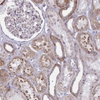 Immunohistochemical staining of human kidney moderate cytoplasmic positivity in cells in tubules.