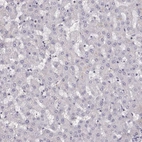 Immunohistochemical staining of human liver shows no membranous positivity in hepatocytes.