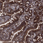 Immunohistochemical staining of human gastrointestinal shows strong cytoplasmic /cytoplasmic membranous positivity in glandular cells.