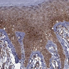 Immunohistochemical staining of human skin shows moderate cytoplasmic positivity in squamous epithelial cells.