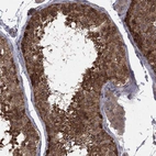 Immunohistochemical staining of human testis shows strong cytoplasmic-nucleus positivity in cells in seminiferous ducts.