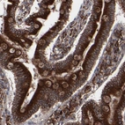 Immunohistochemical staining of human duodenum shows strong cytoplasmic positivity in glandular cells and goblet cells and lymphoid cells.