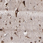 Immunohistochemical staining of human cerebral cortex shows strong cytoplasmic positivity in neuronal cells.