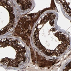Immunohistochemical staining of human testis shows strong cytoplasmic positivity in cells in seminiferous ducts and leydig cells.