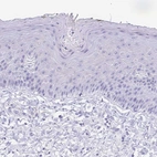 Immunohistochemical staining of human skin shows no positivity in squamous epithelial cells.