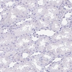 Immunohistochemical staining of human kidney shows no positivity in cells in tubules.
