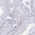 Immunohistochemical staining of human testis shows moderate cytoplasmic positivity in subset of Leydig cells.