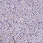 Immunohistochemical staining of human pancreas shows weak cytoplasmic positivity in subset of exocrine glandular cells.